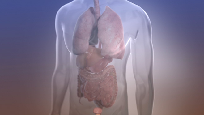 A video about advanced prostate cancer